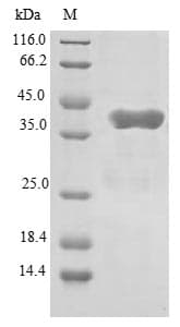 Human GATC Protein (Recombinant GST, N-terminus)
