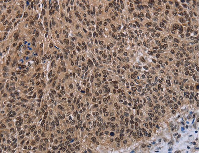 BP1 / DLX4 Antibody