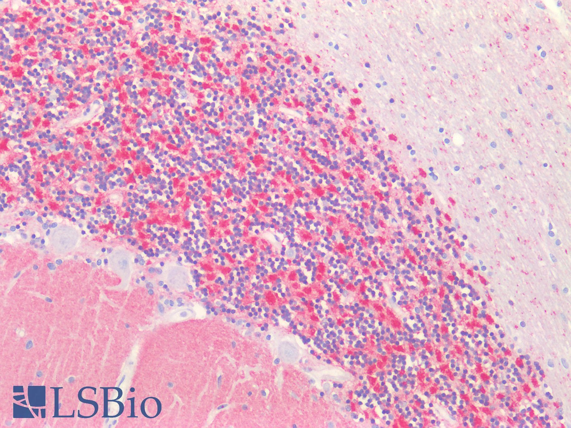 IHC-plus™ NCALD / Neurocalcin Delta Antibody