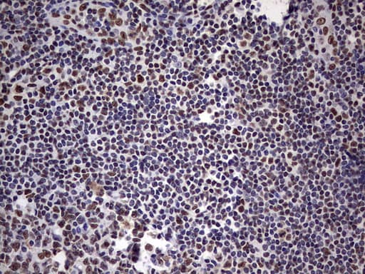 MYF5 / MYF 5 Antibody (clone OTI2G5)