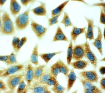 Polyclonal Rabbit anti-Human ANXA5 / Annexin V Antibody (aa88-102, IHC, WB)
