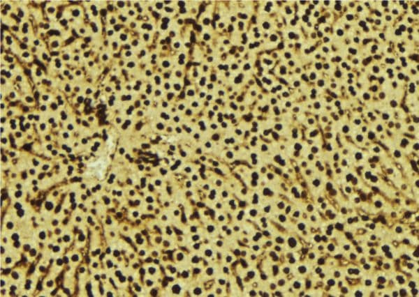 Polyclonal Rabbit anti-Human SDCBP / Syntenin Antibody (IHC, WB)