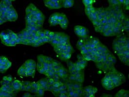 IHC-plus™ Monoclonal Mouse anti-Human CYPOR / POR Antibody (clone 6C4, IHC, IF, WB)