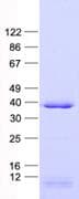 Human SHOX2 Protein (Recombinant His, N-Terminal)