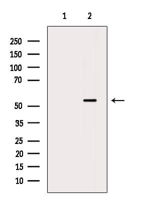 Polyclonal Rabbit anti-Human LPL / Lipoprotein Lipase Antibody (WB)