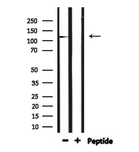 IGHMBP2 Antibody