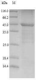 Mouse LY96 / MD2 / MD-2 Protein (Recombinant 6His-SUMO, N-terminus)