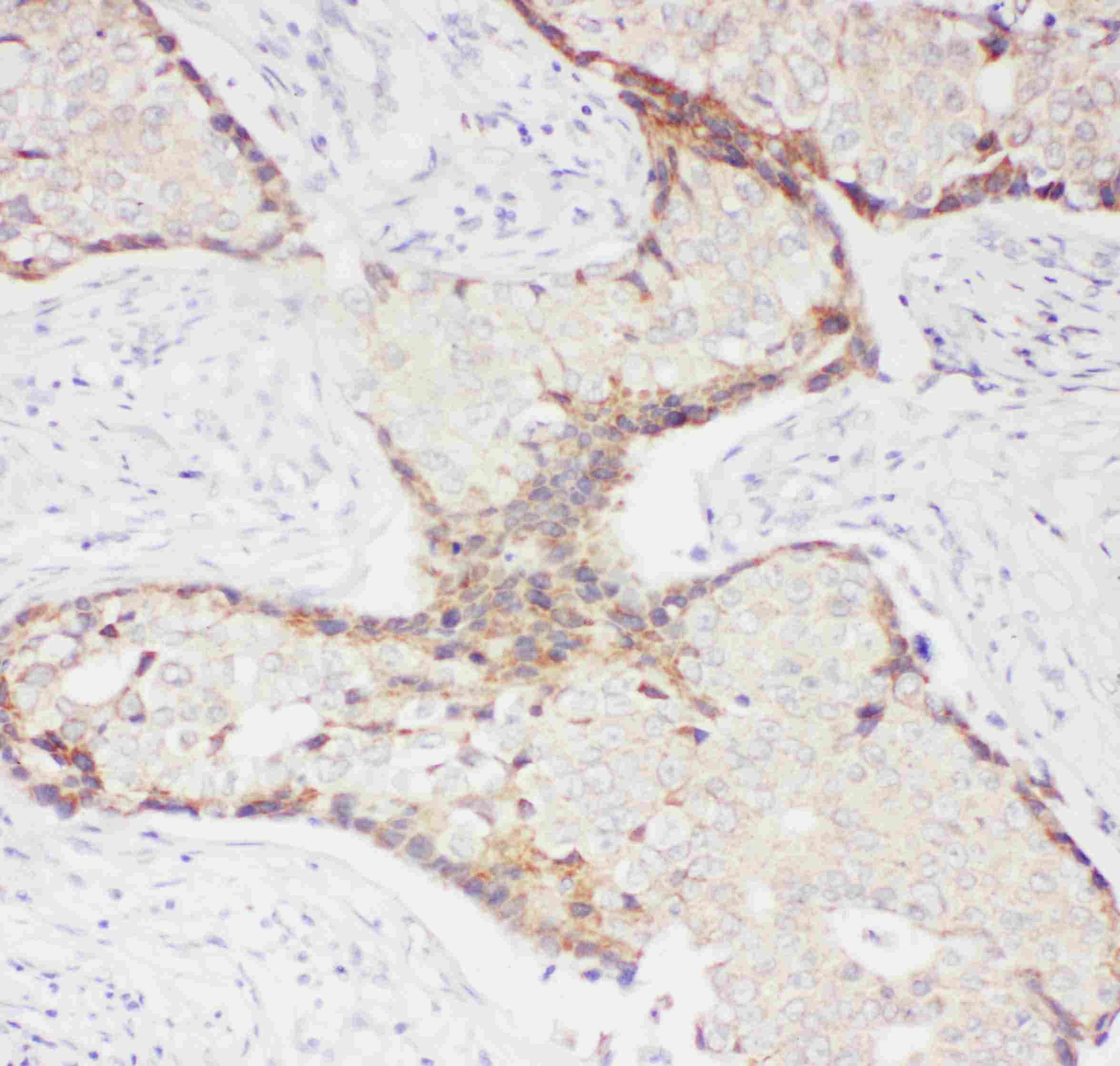 SELP / P-Selectin / CD62P Antibody (aa49-66)