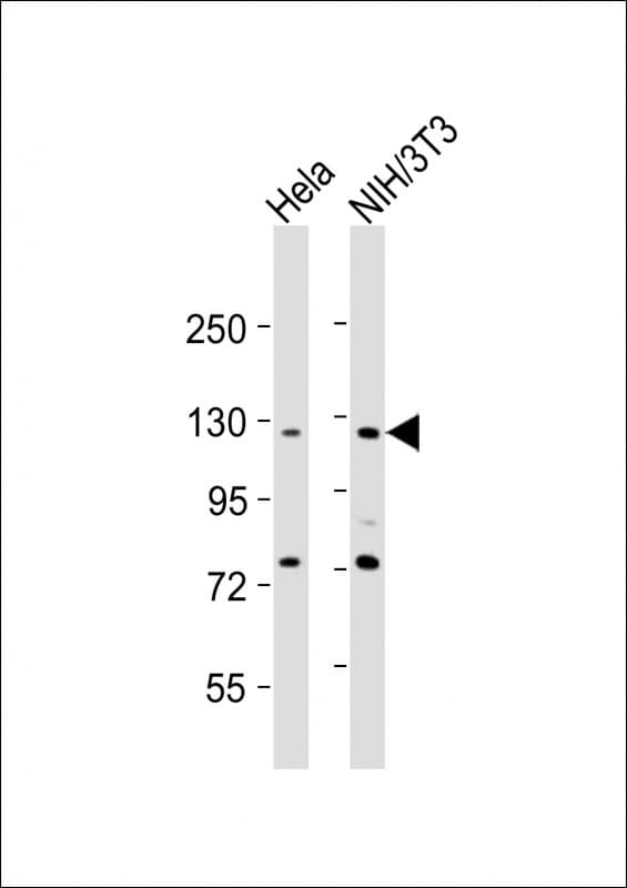 AATK / AATYK Antibody (aa55-90)