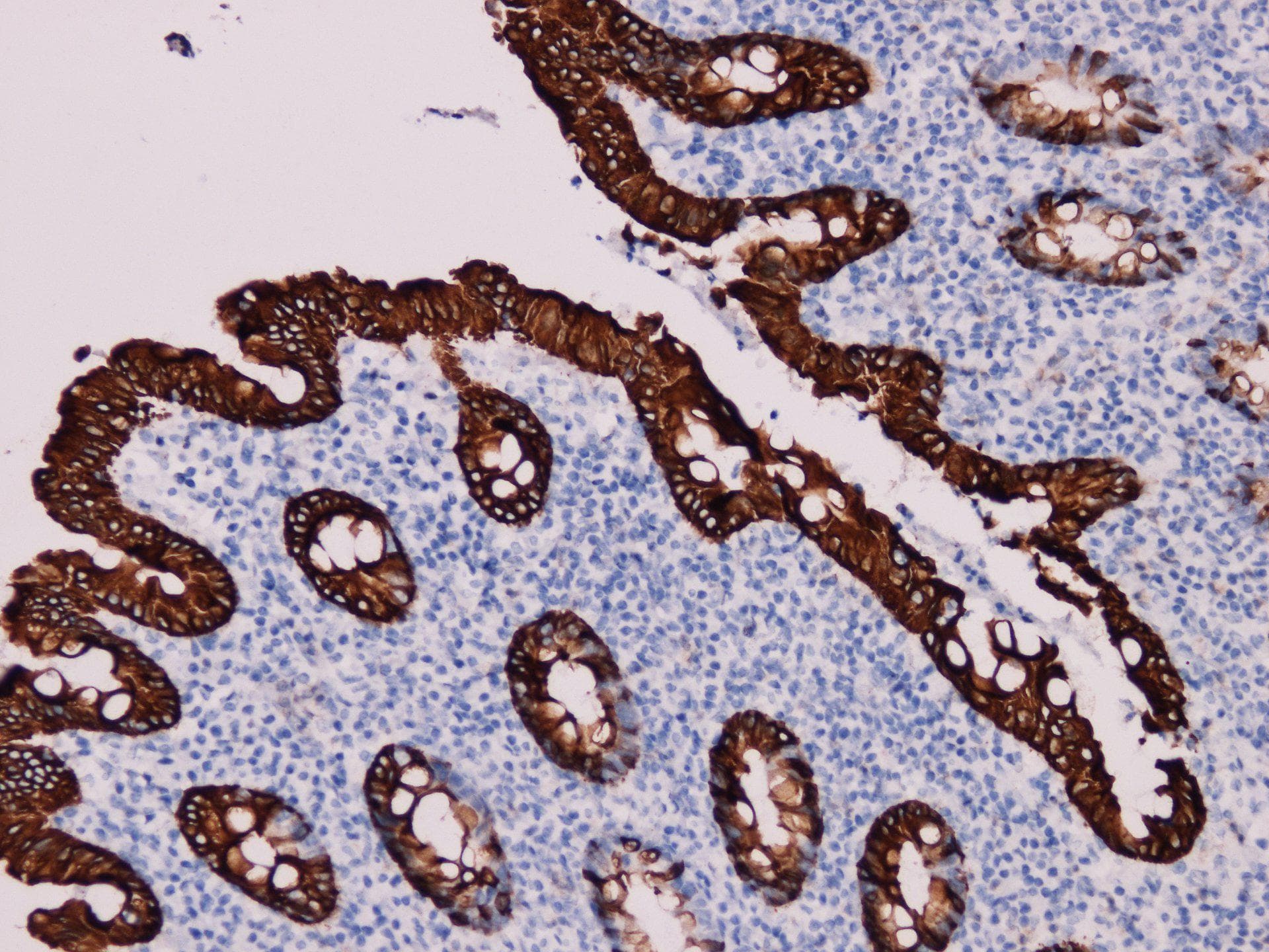KRT20 / CK20 / Cytokeratin 20 Antibody