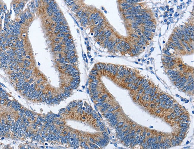 Polyclonal Rabbit anti-Human NECL-1 / CADM3 Antibody (IHC)