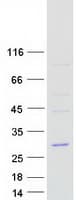 Human COPZ2 Protein (Recombinant Myc-DDK (Flag))