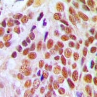 NUMA1 / NUMA Antibody (N-Terminus)