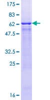 Human GNAT2 Protein (Recombinant GST)
