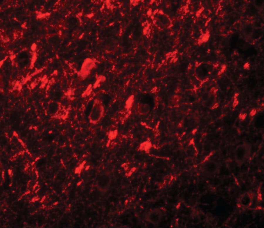IHC-plus™ Polyclonal Rabbit anti-Human NOD8 / NLRP10 Antibody (IHC, IF, WB)