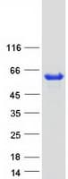 Human PPM1H Protein (Recombinant Myc-DDK (Flag))