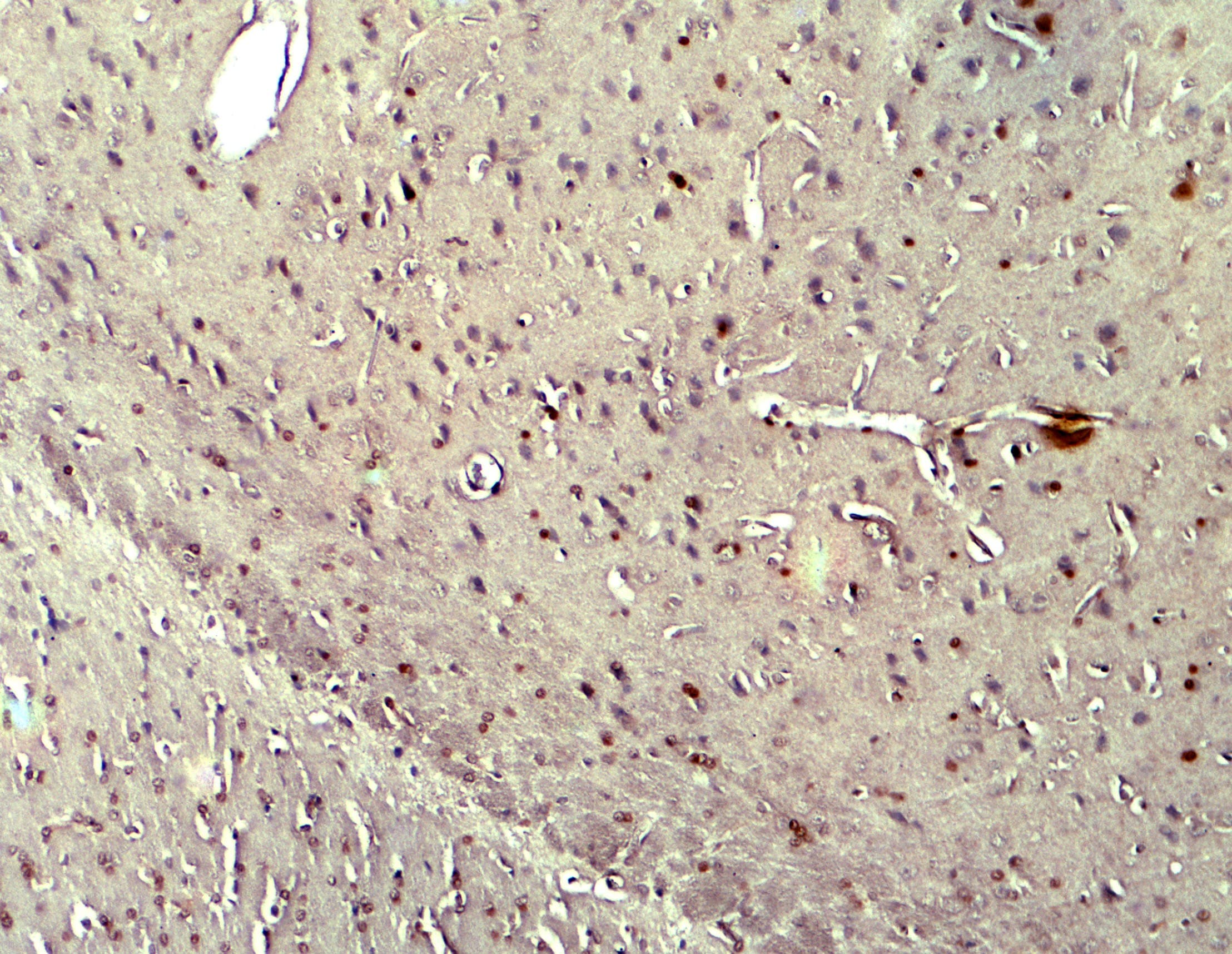 CYBB / NOX2 / gp91phox Antibody