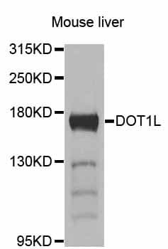 DOT1L / DOT1 Antibody
