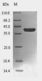 Mycoplasma pneumoniae Sw:lon_bacbr P36772 Atp-dependent Protease La ; Protein (Recombinant 6His-SUMO, N-terminus)