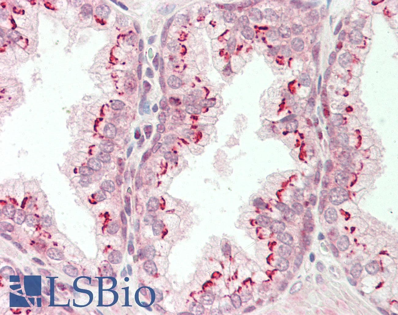 IHC-plus™ Polyclonal Rabbit anti-Human CTNNB1 / Beta Catenin Antibody (Internal, IHC, WB)
