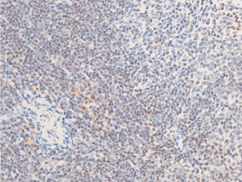 Polyclonal Rabbit anti-Human ERBB2 / HER2 Antibody (phospho-Tyr1112, IHC, IF, WB)