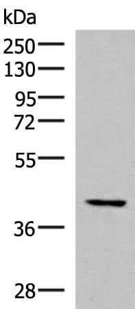 Polyclonal Rabbit anti-Human IST1 Antibody (IHC, WB)