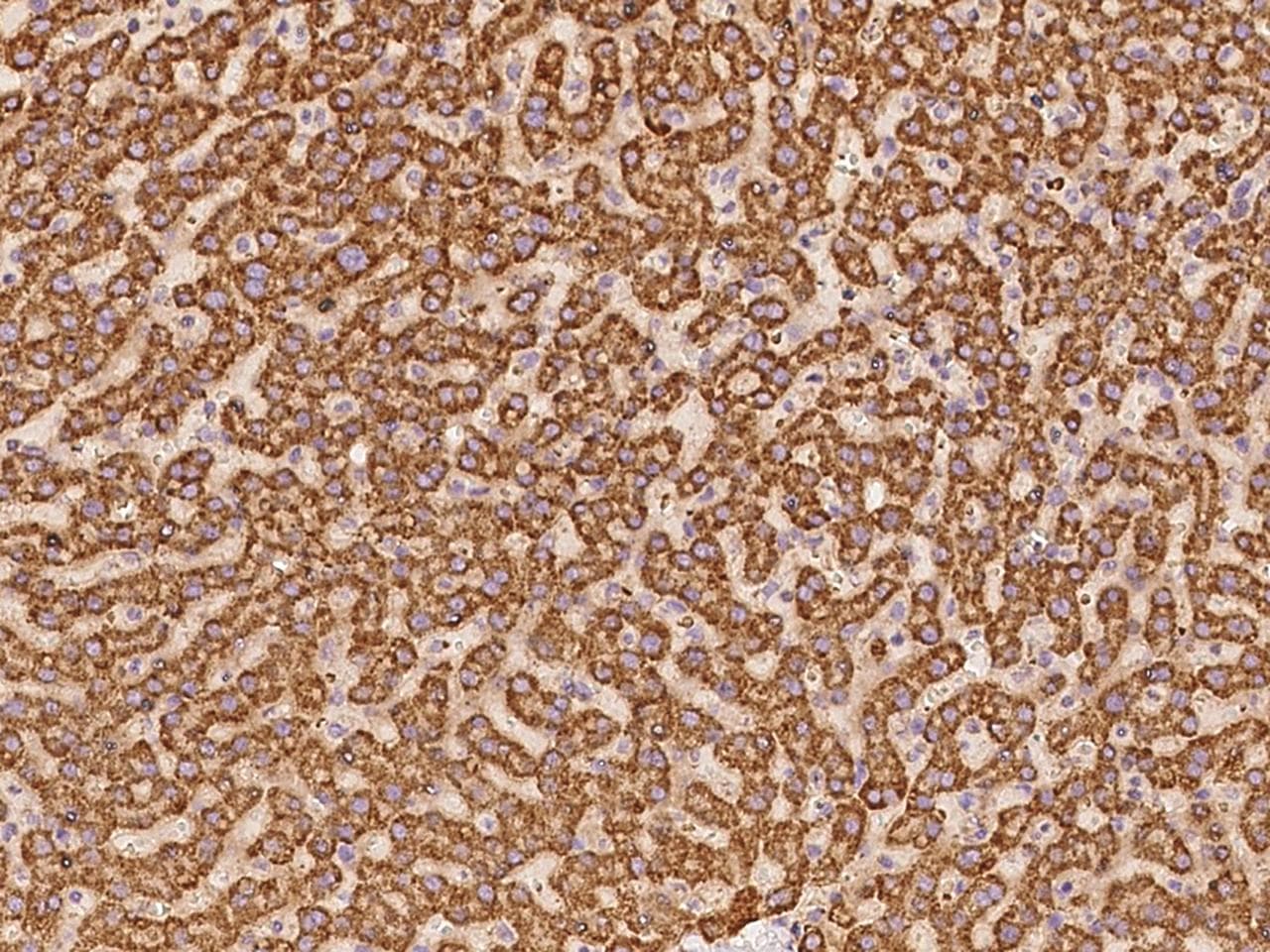 Polyclonal Rabbit anti-Human ERI2 / EXOD1 Antibody (IHC)