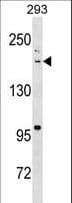 BAZ1B / WSTF Antibody (aa157-186)