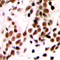 GTF3 / GTF2IRD1 Antibody (N-Terminus)