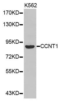 CCNT1 / Cyclin T1 Antibody