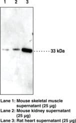 PathPlus™ IGFBP5 Antibody