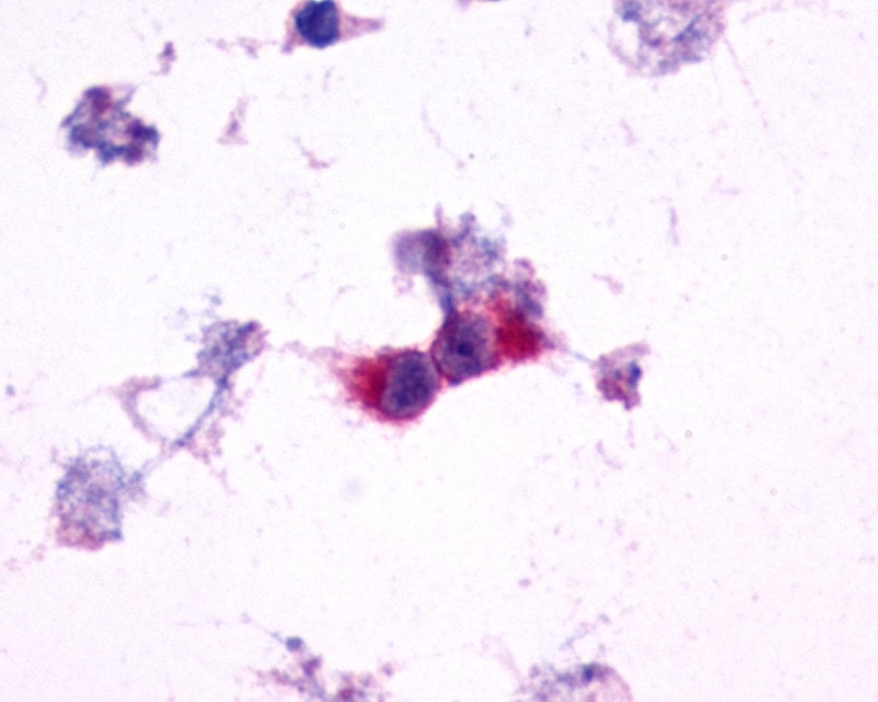 PathPlus™ GRM2 / MGLUR2 Antibody (N-Terminus)