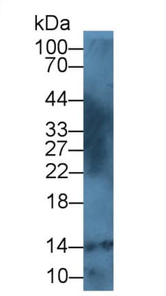 S100A12 Antibody (aa2-92)