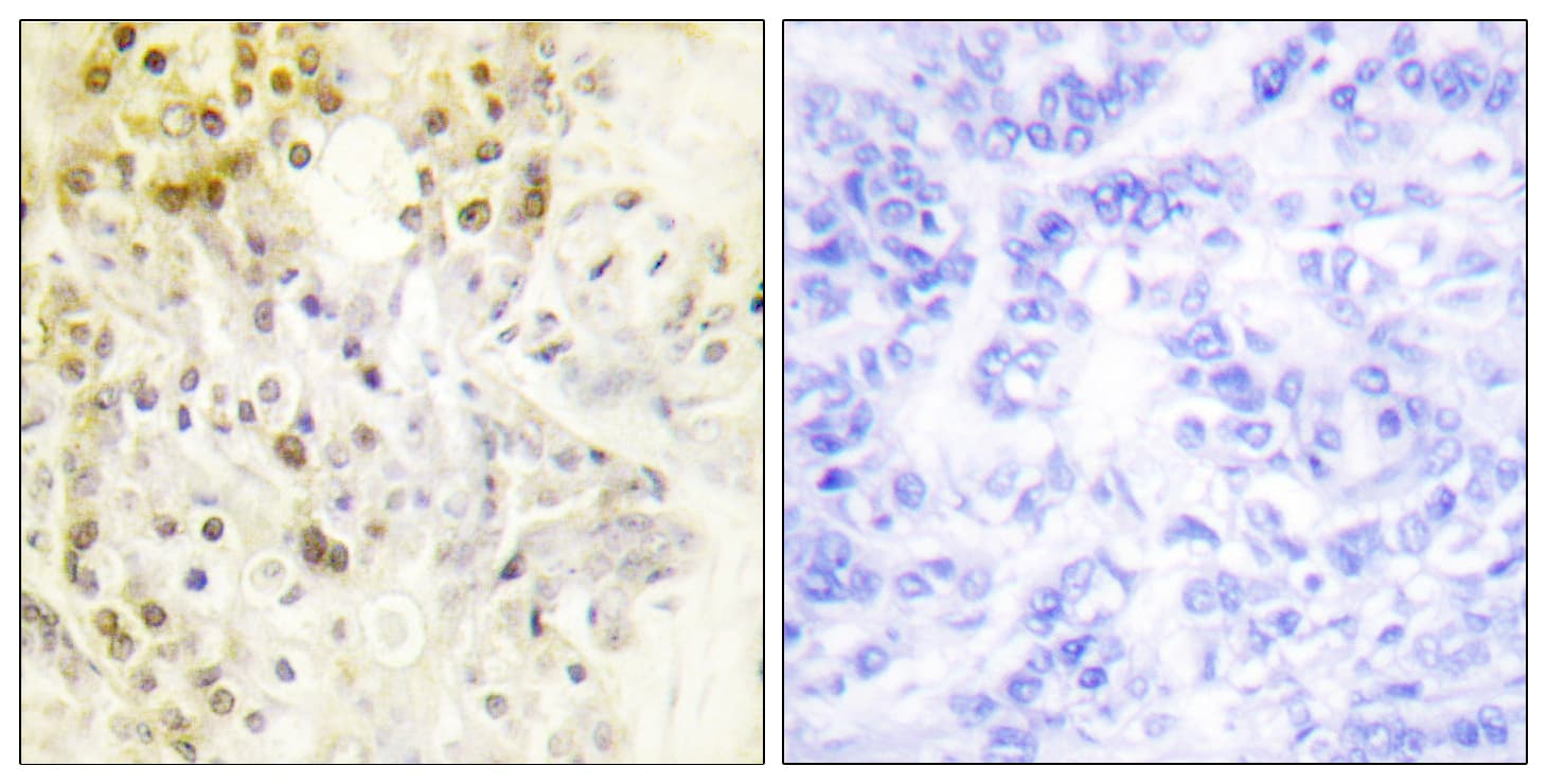 Polyclonal Rabbit anti-Human CCNL1 / Cyclin L1 Antibody (aa461-510, IHC, WB)