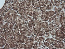 Monoclonal Mouse anti-Human MAPK3 / ERK1 Antibody (clone OTI4D7, IHC, IF, WB)