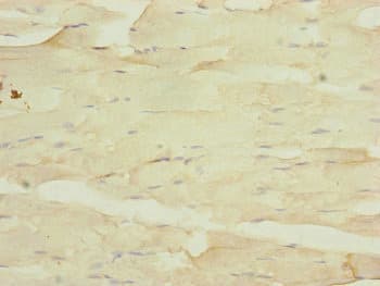 MYO5B / Myosin VB Antibody