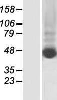 KRT80 / Keratin 80 Protein (Over-Expression Lysate Myc-DDK (Flag))