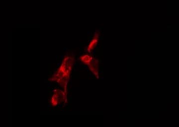 Polyclonal Rabbit anti-Human FSH Receptor / FSHR Antibody (IHC, IF, WB)
