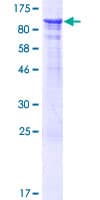 Human FEM1A Protein (Recombinant GST)