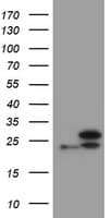 UBE2E3 Antibody (clone OTI3F7)