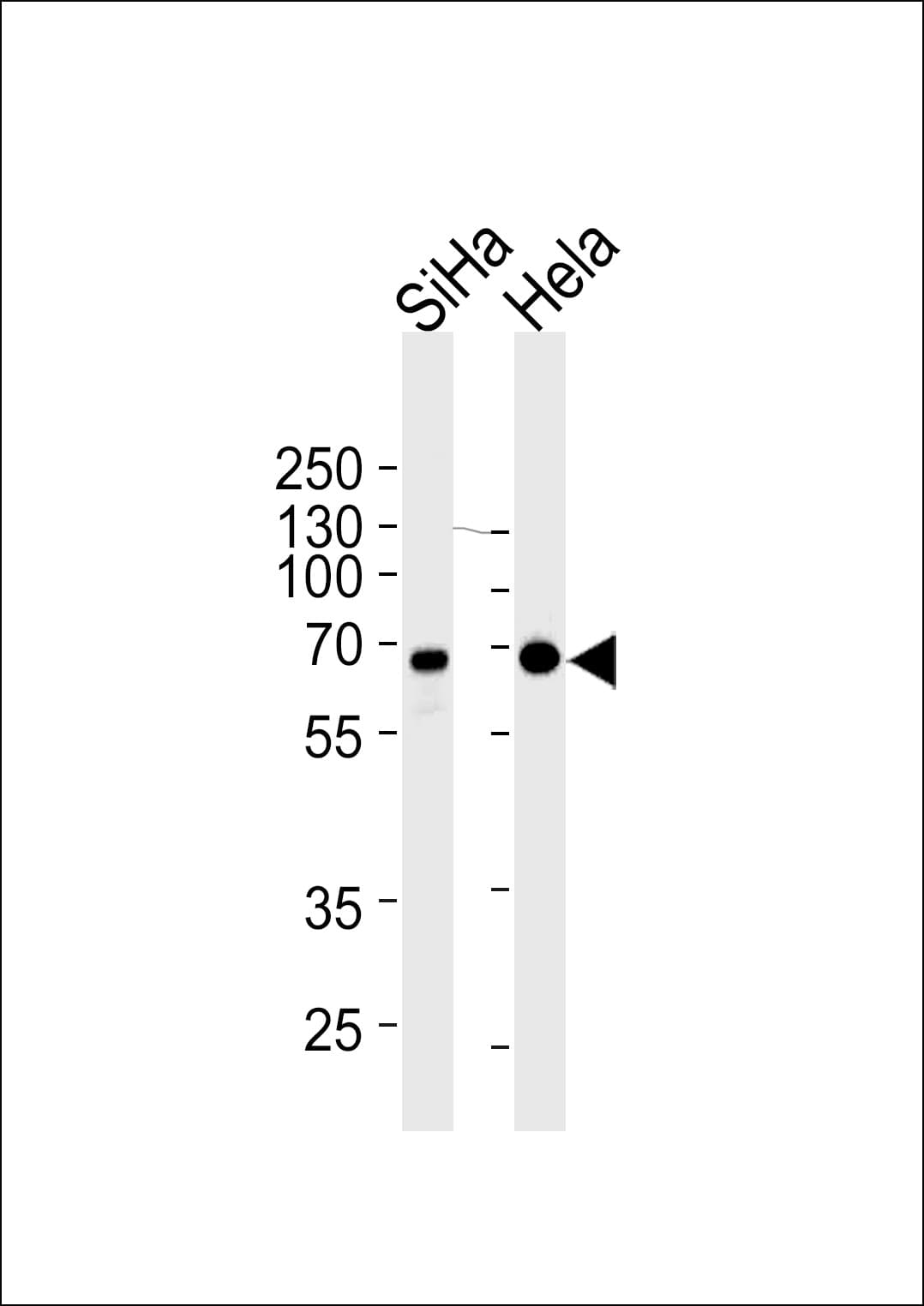 NLK Antibody (clone 1146CT24.2.1)