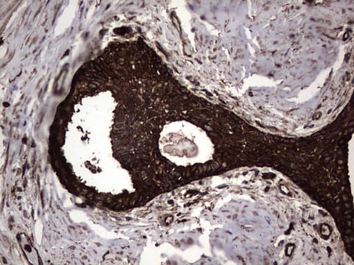 PKM2 Antibody (clone 14C7)