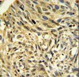 Polyclonal Rabbit anti-Human FKBP14 Antibody (aa37-68, IHC, WB)