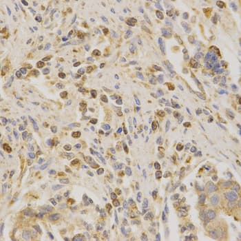 Polyclonal Rabbit anti-Human BAK1 / BAK Antibody (IHC, IF, WB)