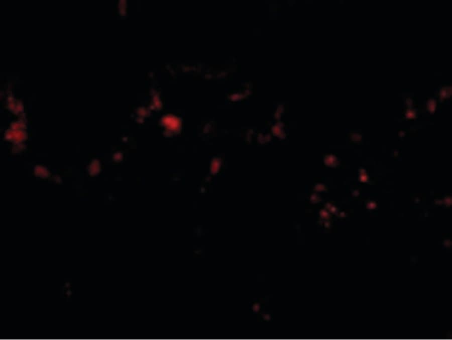 IHC-plus™ RRM2B / P53R2 Antibody