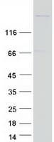 Human MYH4 Protein (Recombinant Myc-DDK (Flag))