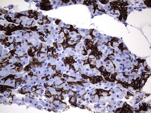 IHC-plus™ Acidic Cytokeratin Antibody (clone 1D10)