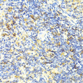 Polyclonal Rabbit anti-Human ARRB1 / Beta Arrestin 1 Antibody (IHC, IF, WB)