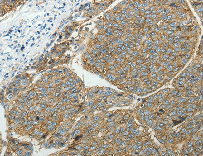 Polyclonal Rabbit anti-Human SLC16A1 / MCT1 Antibody (IHC)