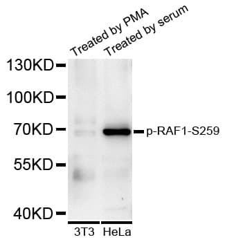 RAF1 / RAF Antibody (phospho-Ser259)